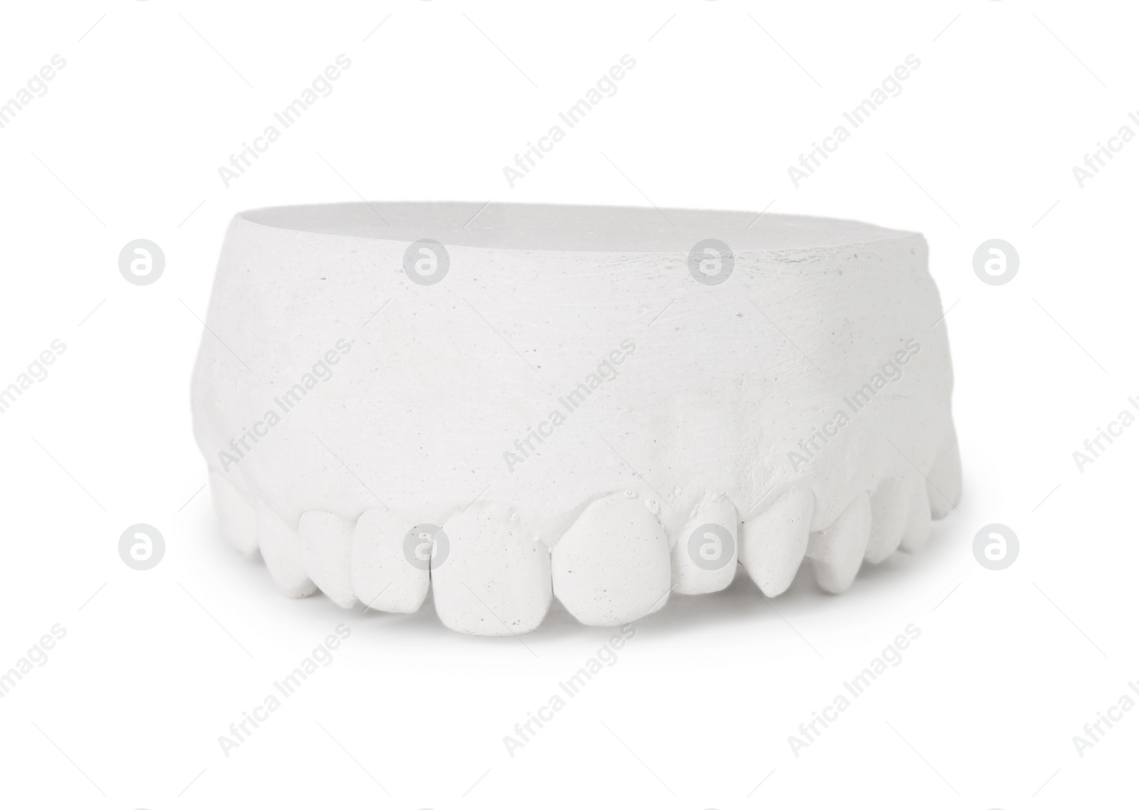 Photo of Dental model with gum isolated on white. Cast of teeth