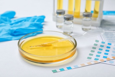 Photo of Glass dish with urine sample on table. Urology concept