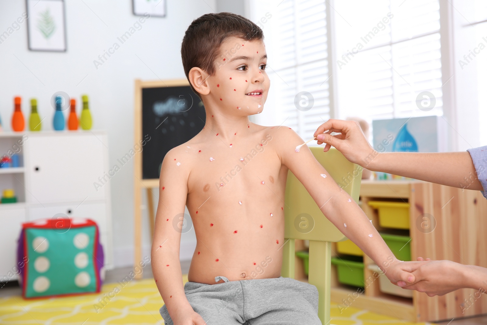 Photo of Woman applying cream onto skin of little boy with chickenpox at home