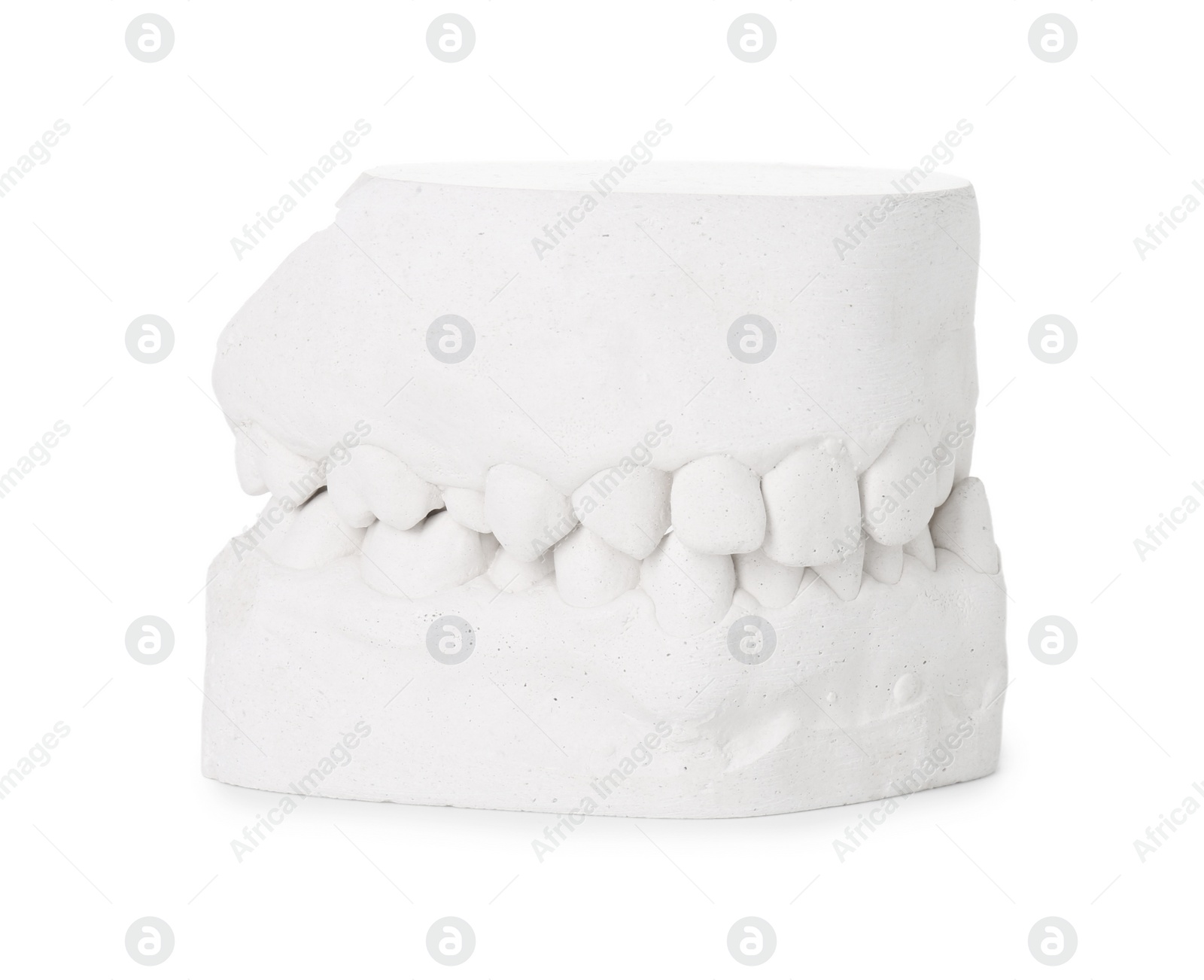 Photo of Dental model with gums isolated on white. Cast of teeth