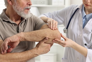 Photo of Arthritis symptoms. Doctor examining patient's elbow in hospital