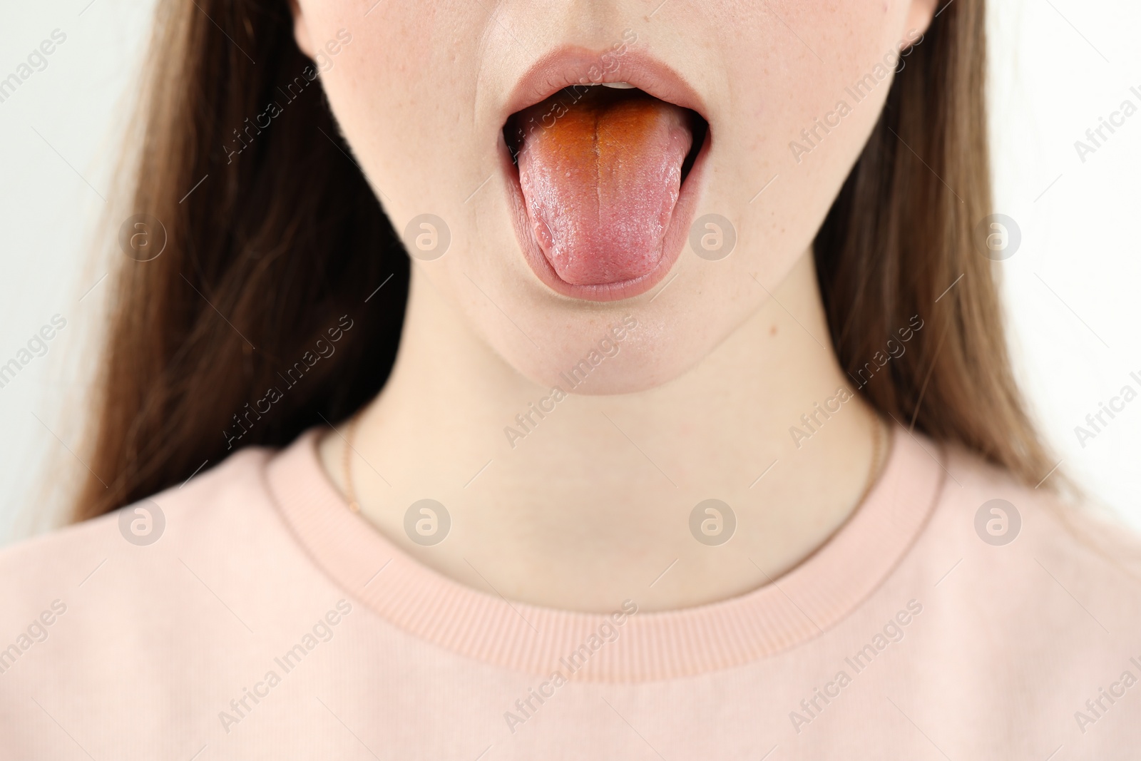 Photo of Gastrointestinal diseases. Woman showing her yellow tongue on white background, closeup