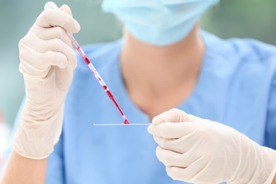 Scientist dripping blood sample on glass in laboratory