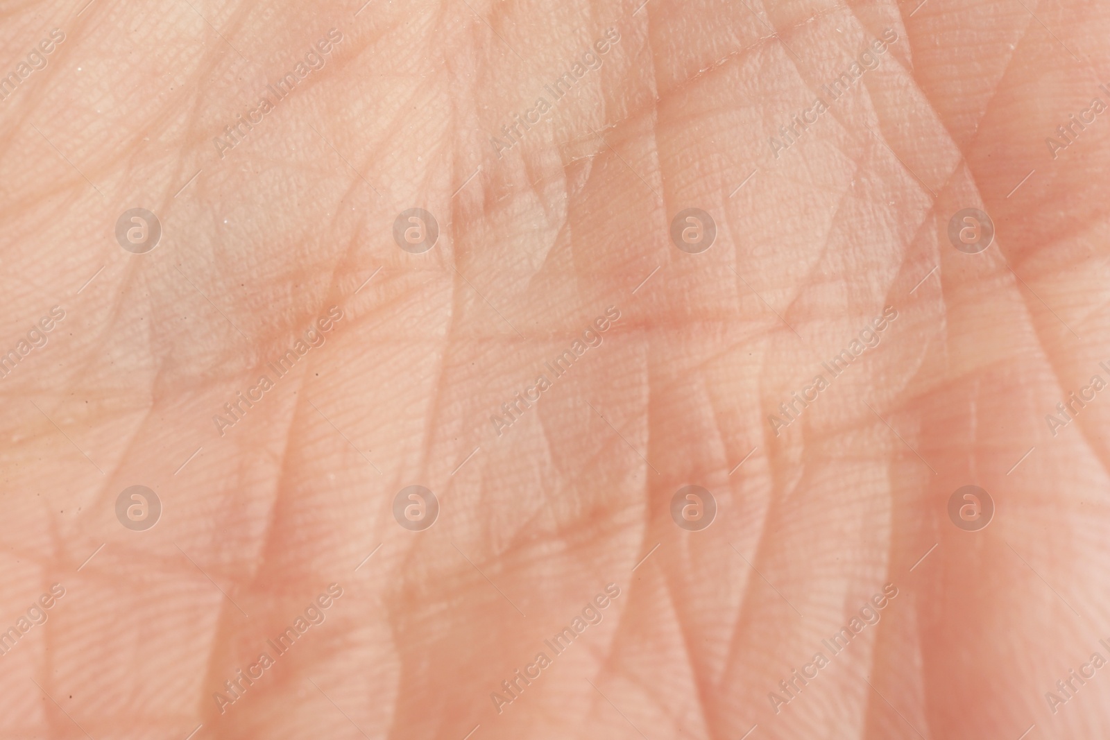 Photo of Texture of dry skin as background, macro view