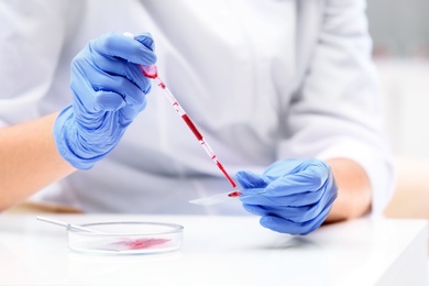 Scientist dripping blood sample on glass in laboratory