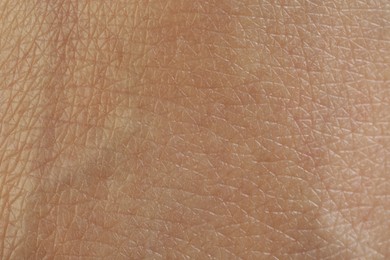 Photo of Texture of healthy skin as background, macro view