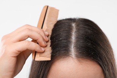Photo of Woman with comb examining her hair and scalp on white background, closeup. Dandruff problem