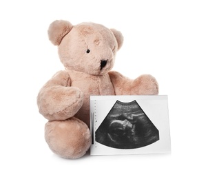 Photo of Ultrasound photo of baby and toy teddy bear on white background. Concept of pregnancy