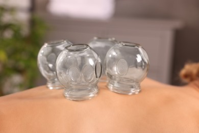 Photo of Cupping therapy. Closeup view of woman with glass cups on her back indoors