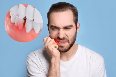 Image of Young man suffering from toothache on light blue background