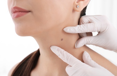 Dermatologist examining patient in clinic, closeup view