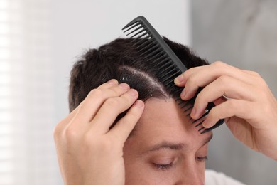 Photo of Dandruff problem. Man with comb examining his hair and scalp on light background, closeup