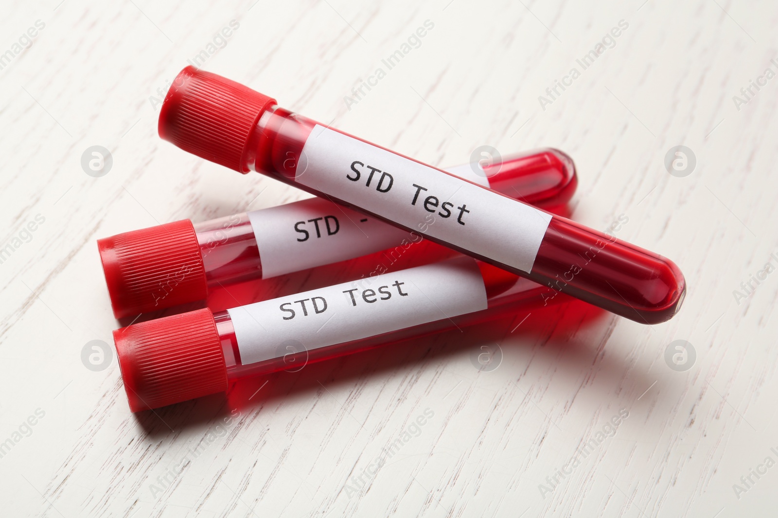 Photo of Tubes with blood samples and labels STD Test on white wooden table