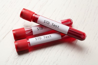 Tubes with blood samples and labels STD Test on white wooden table