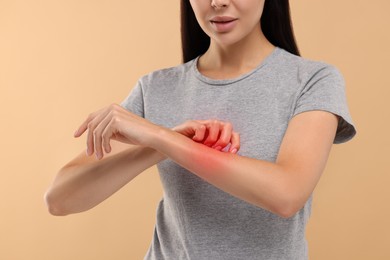 Photo of Young woman scratching her arm on beige background, closeup