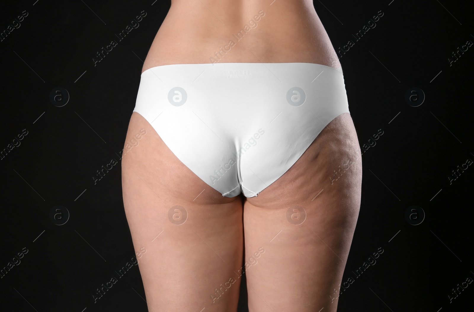 Photo of Woman with cellulite on black background, closeup