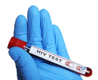 Photo of Scientist holding tube with blood sample and label HIV Test on white background, closeup