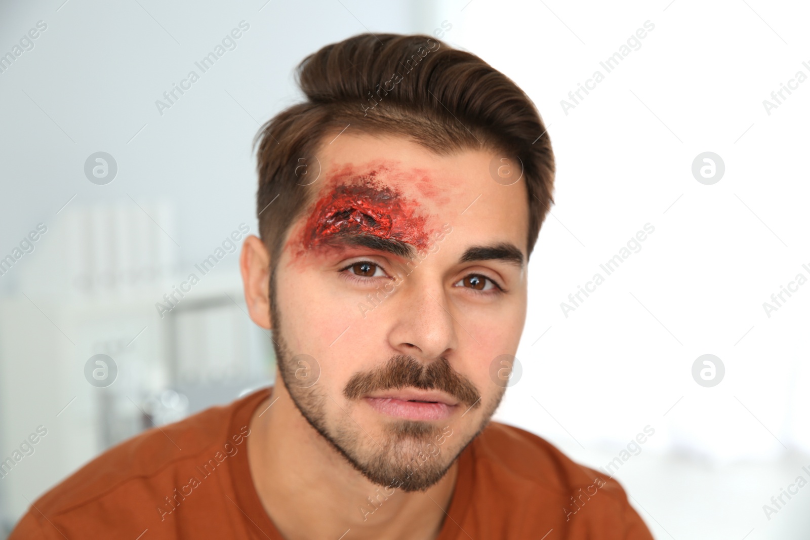 Photo of Young man with head injury in clinic. First aid