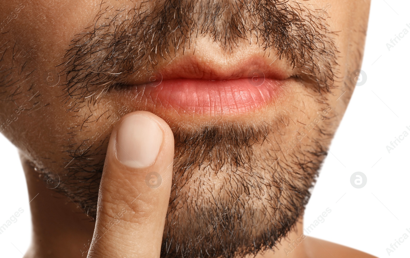 Image of Young man with cold sore touching lips against white background, closeup