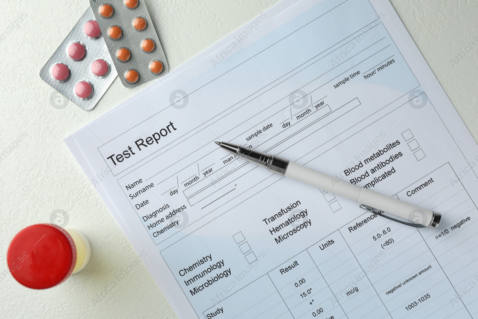 Photo of Drug test result form, container with urine sample and pills on light table, flat lay