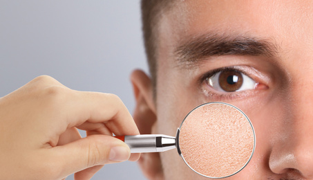 Image of Man with dry skin visiting dermatologist, closeup