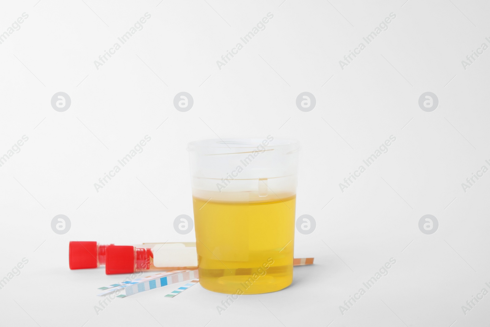 Photo of Laboratory ware with urine samples for analysis on white background