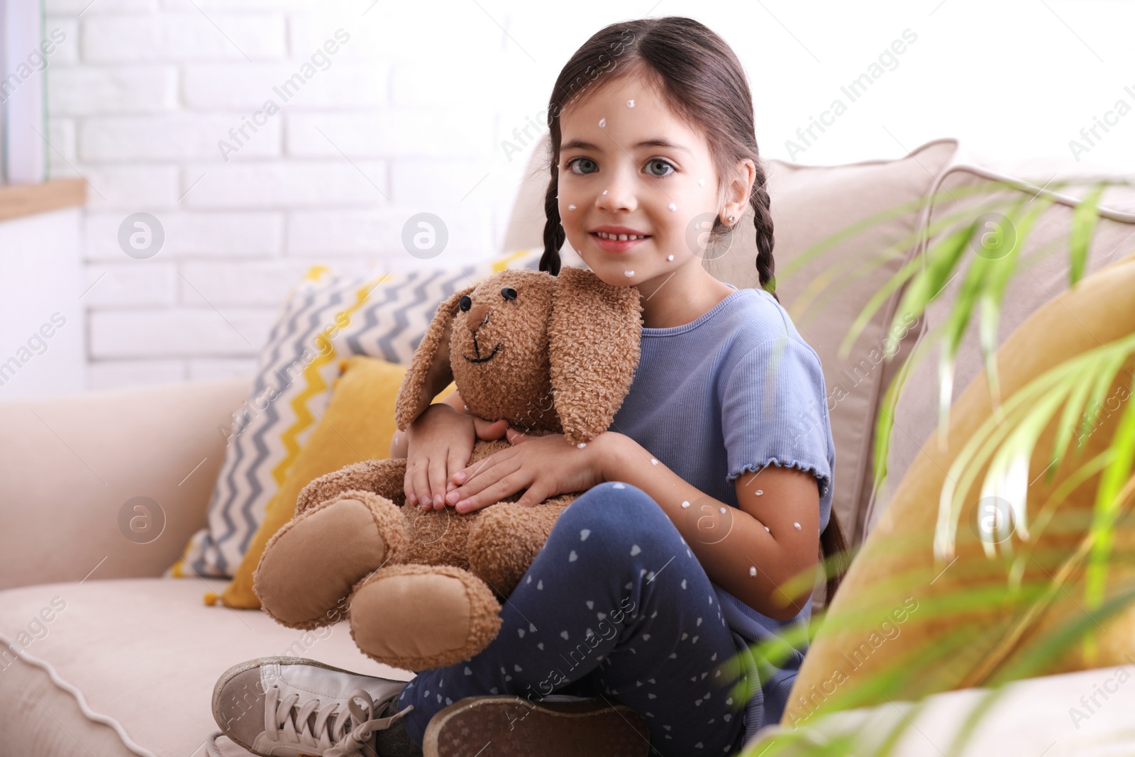 Photo of Little girl with chickenpox playing at home