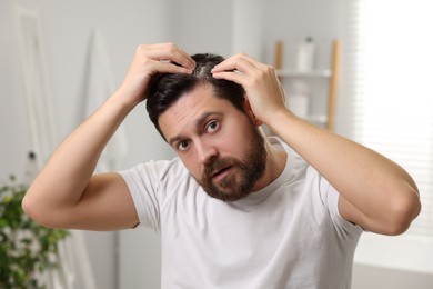 Man with dandruff in his dark hair at home