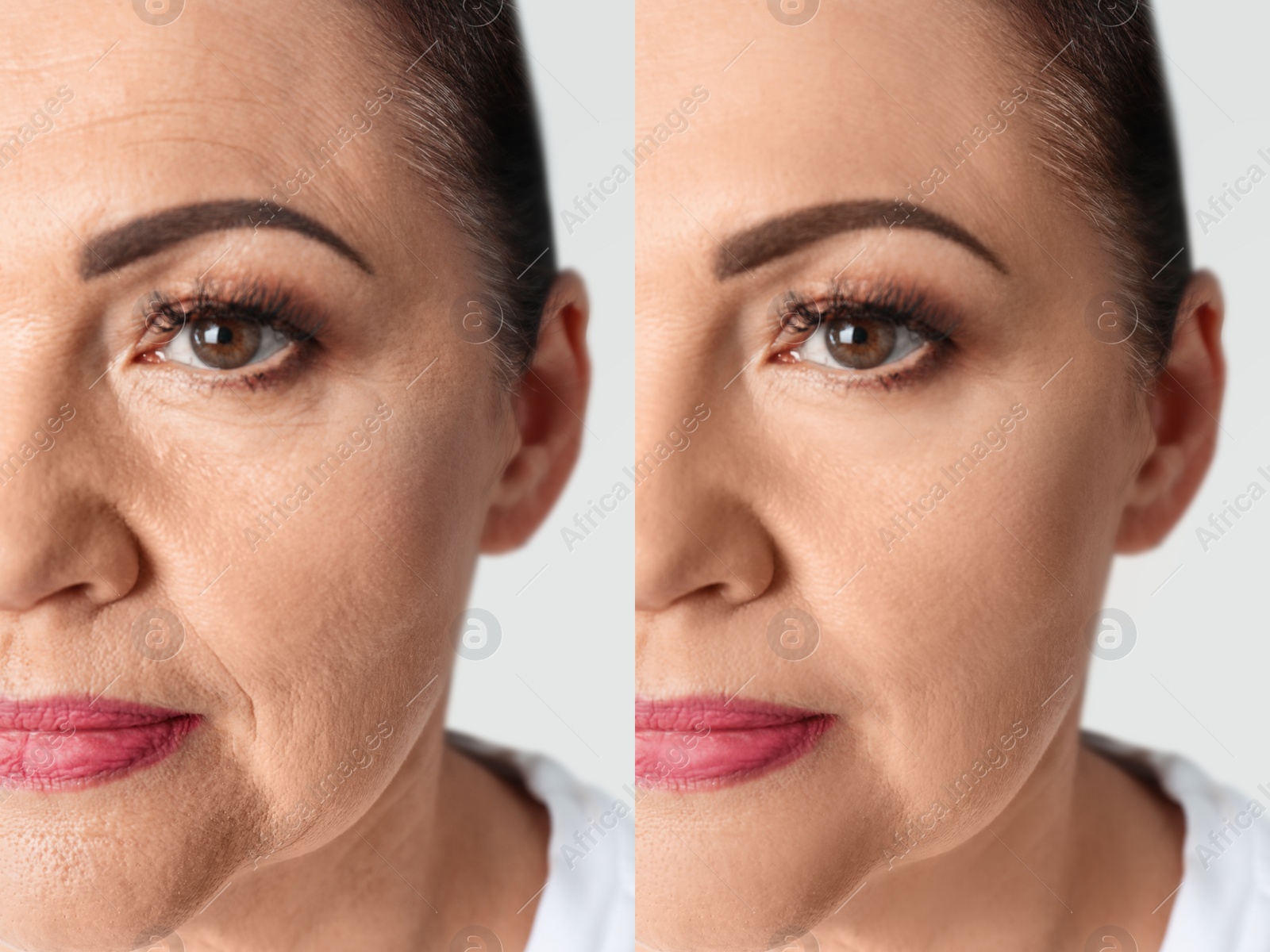 Image of Woman looking better due to cosmetic procedures, closeup. Collage with photos on white background before and after rejuvenation