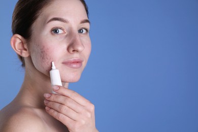 Photo of Young woman with acne problem applying cosmetic product onto her skin on blue background. Space for text