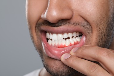 Image of Man showing inflamed gum on grey background, closeup