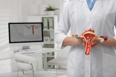 Photo of Gynecologist demonstrating model of female reproductive system in clinic, closeup