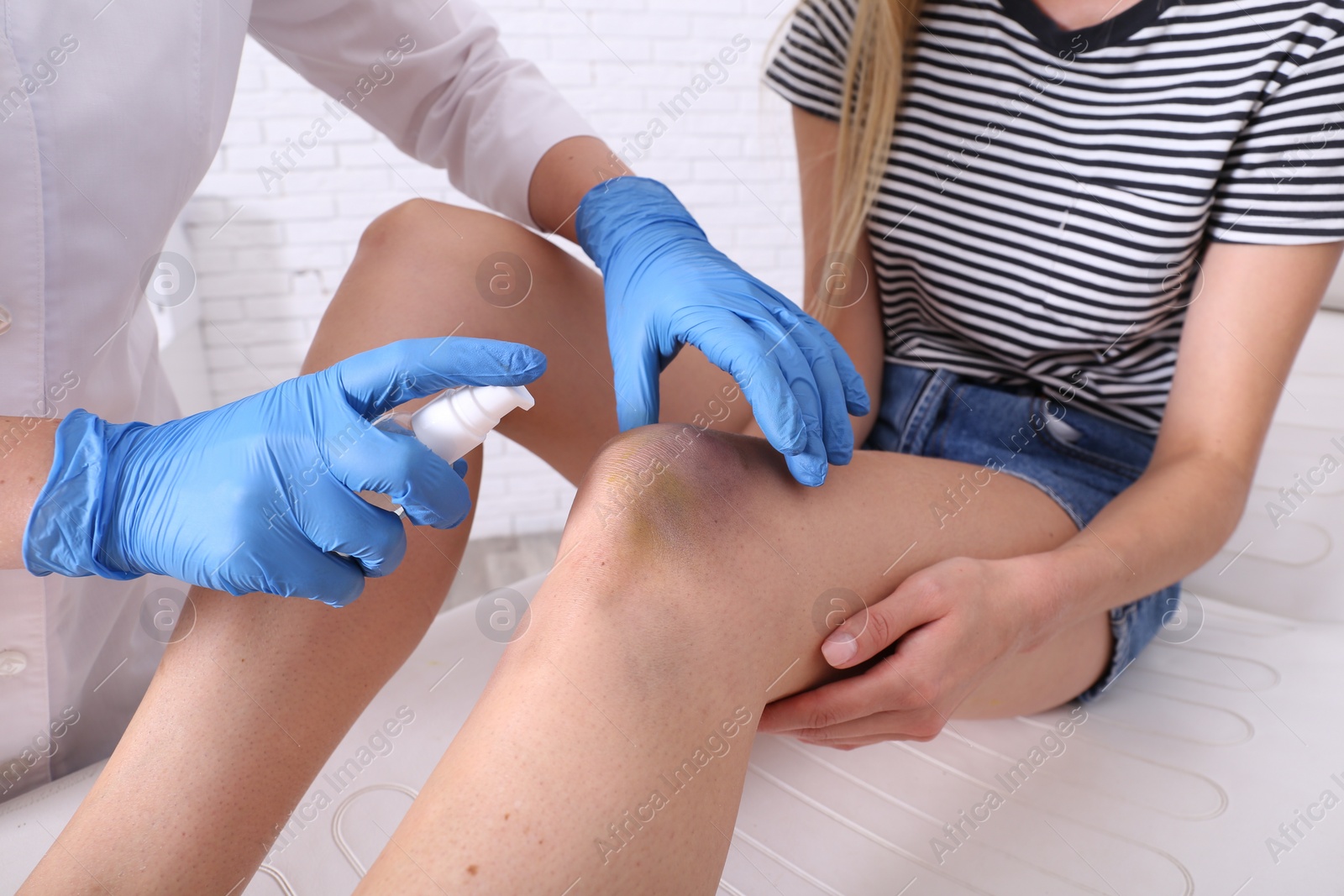 Photo of Doctor spraying woman's knee bruise in hospital, closeup