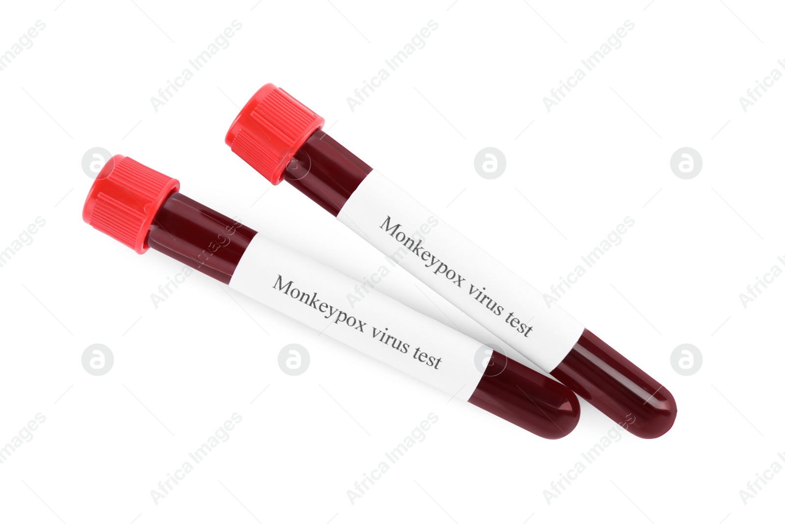 Photo of Monkeypox virus test. Sample tubes with blood on white background