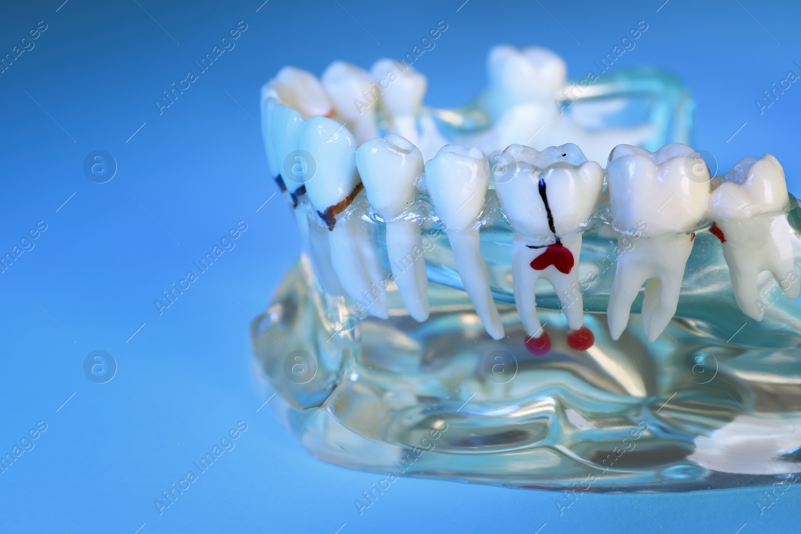 Photo of Educational dental typodont model with teeth on light blue background, closeup