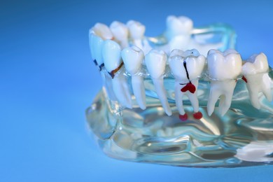 Photo of Educational dental typodont model with teeth on light blue background, closeup