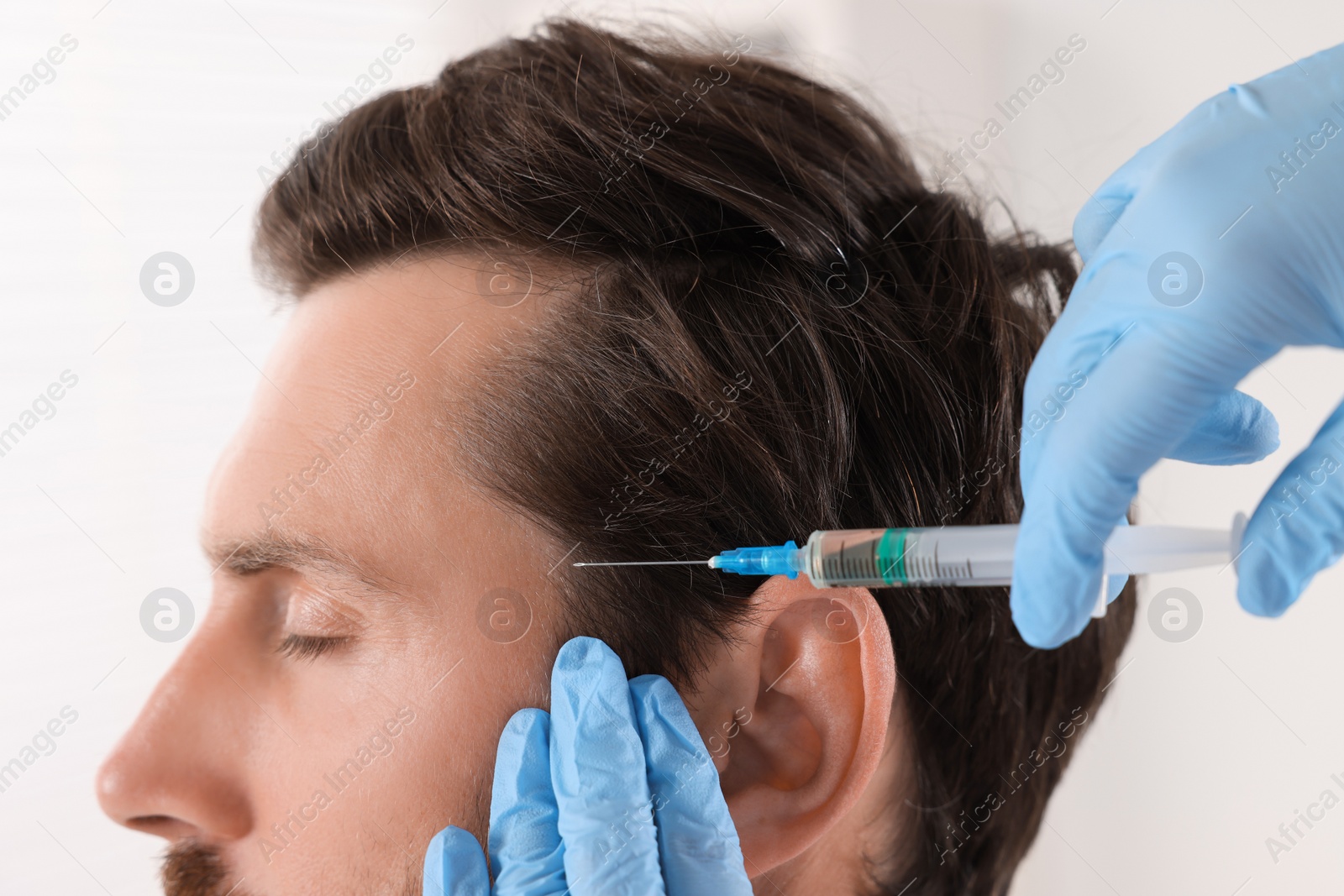 Photo of Trichologist giving injection to patient in clinic, closeup