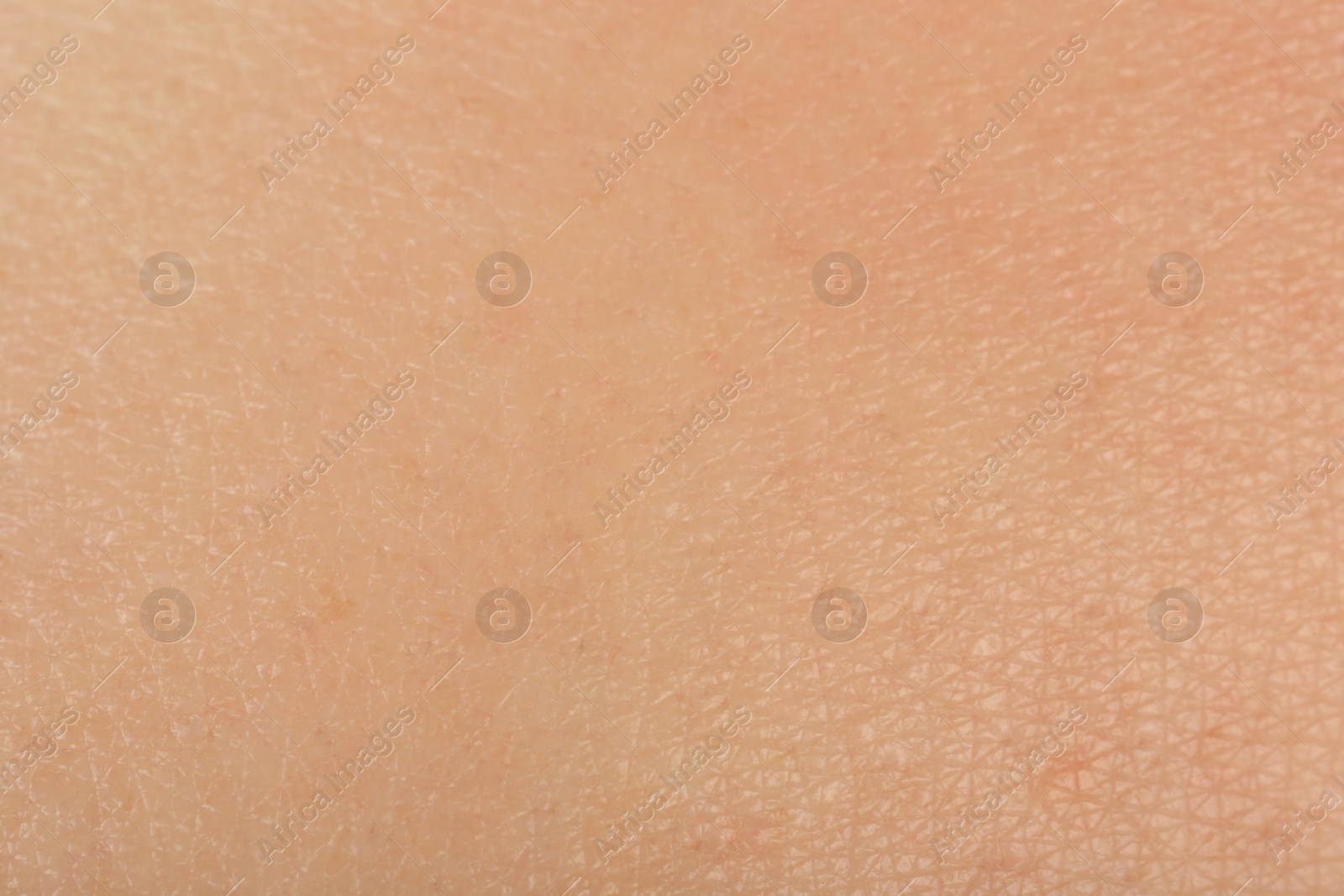 Photo of Texture of healthy skin as background, macro view