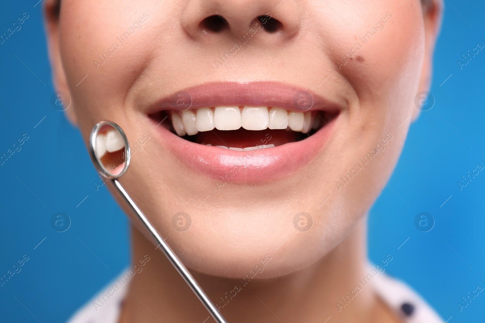 Photo of Young woman with mouth mirror on blue background, closeup. Cosmetic dentistry