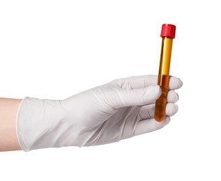 Woman holding test tube with brown liquid on white background, closeup