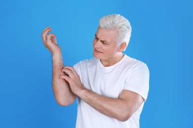 Photo of Senior man scratching forearm on color background. Allergy symptom