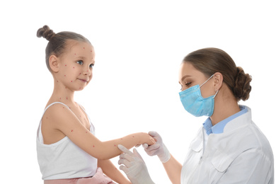 Photo of Doctor examining little girl with chickenpox on white background. Varicella zoster virus