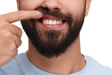 Man showing his clean teeth on white background, closeup