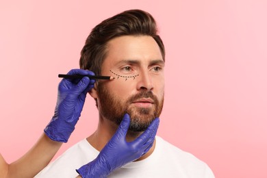 Man preparing for cosmetic surgery, pink background. Doctor drawing markings on his face, closeup