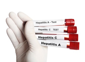 Scientist holding tubes with blood samples for hepatitis virus test on white background, closeup