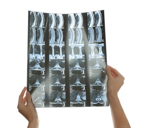 Photo of Doctor examining neck MRI image on white background, closeup