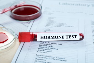 Hormone test. Sample tube with blood and laboratory form on table, closeup