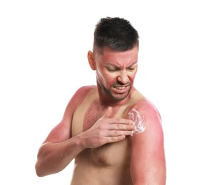 Photo of Man applying cream on sunburn against white background