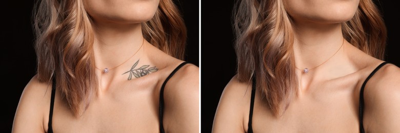 Image of Woman before and after laser tattoo removal procedure on black background, closeup. Collage with photos, banner design