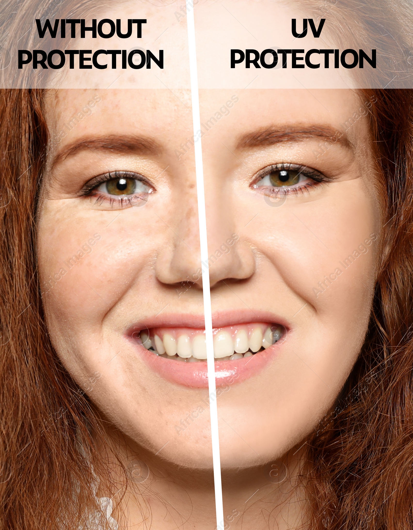 Image of Young woman without and with sun protection cream on her face, closeup